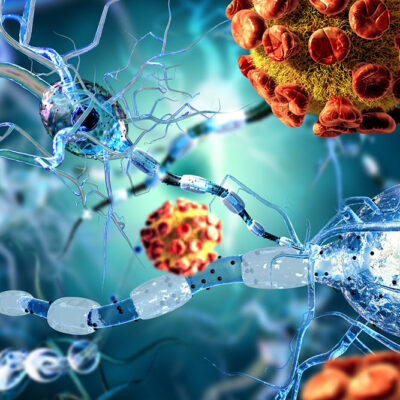 All you need to know about immunodeficiency disorders