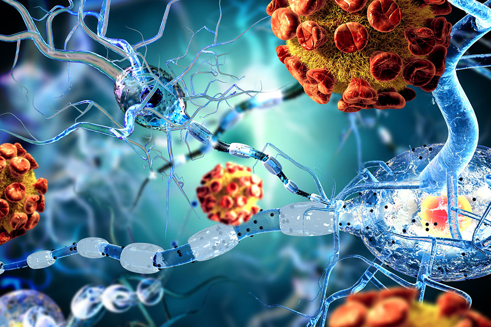 All you need to know about immunodeficiency disorders