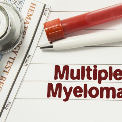 Multiple myeloma &#8211; Symptoms, causes, and risk factors