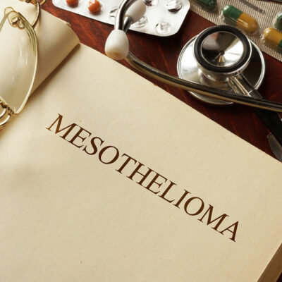 4 causes that can trigger mesothelioma