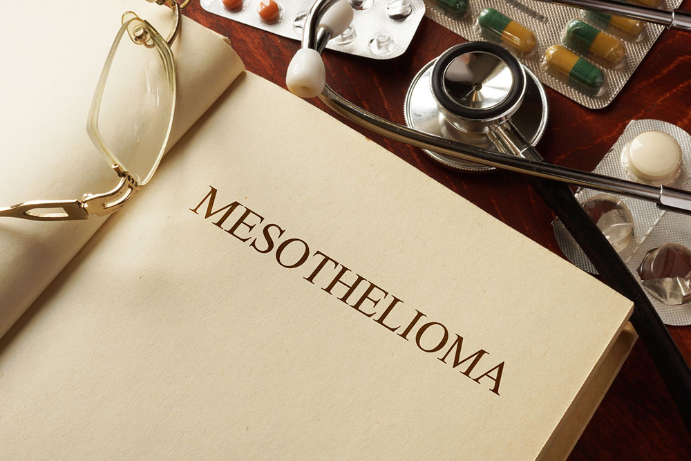 4 causes that can trigger mesothelioma