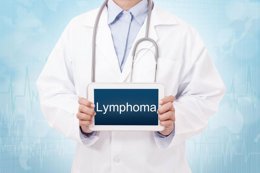 4 methods of treatment for non-Hodgkin&#8217;s lymphoma