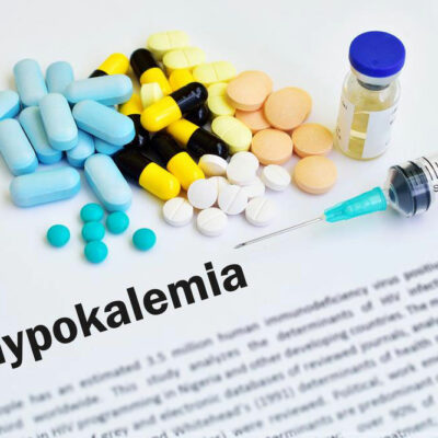 Causes, symptoms, and treatment for hypokalemia