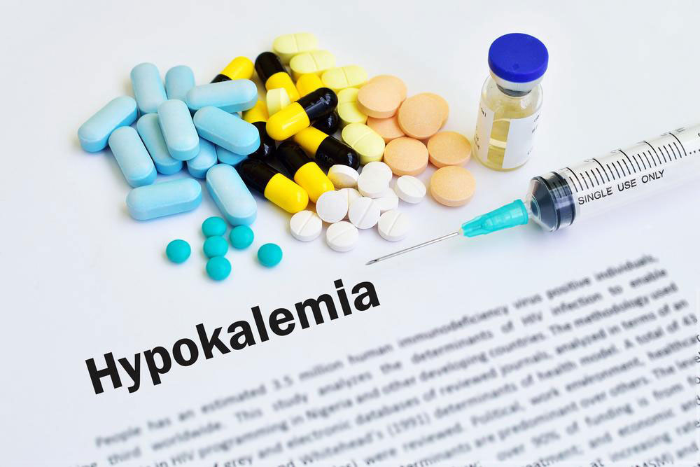 Causes, symptoms, and treatment for hypokalemia