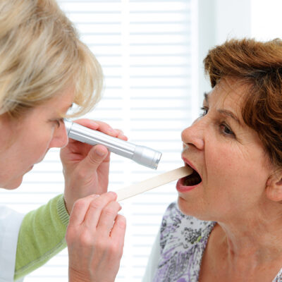 Common symptoms and treatments of oral thrush