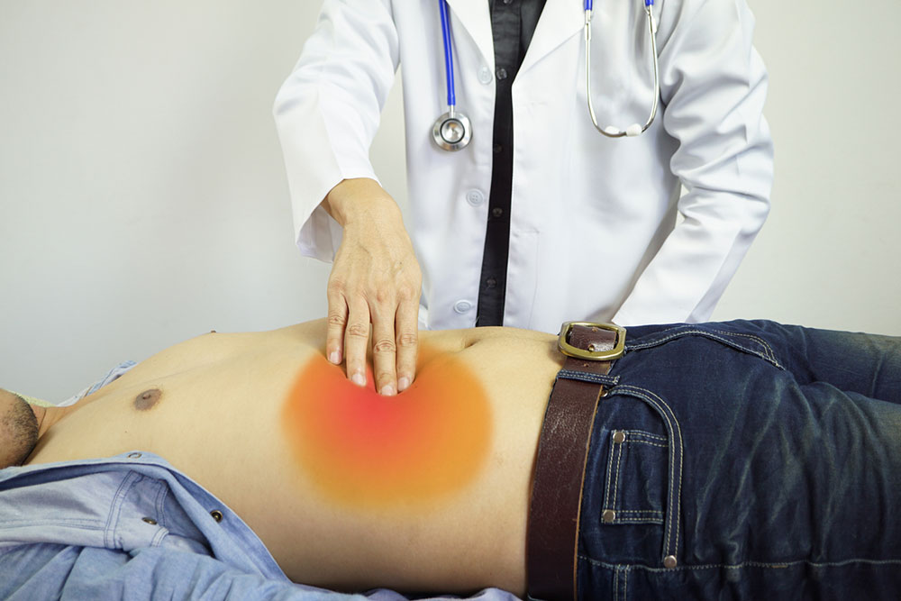 Symptoms, causes, and prevention of gallstones