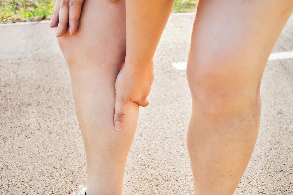 Ways to manage deep vein thrombosis at home