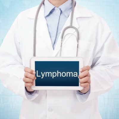 An Overview of Lymphoma Types
