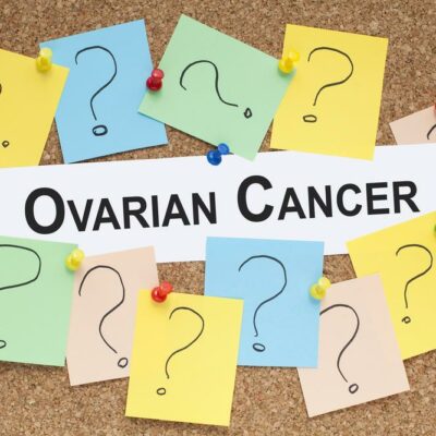 Screening and Treatment Options for Ovarian Cancer