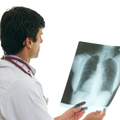 6 Effective Ways of Treating Lung Cancer