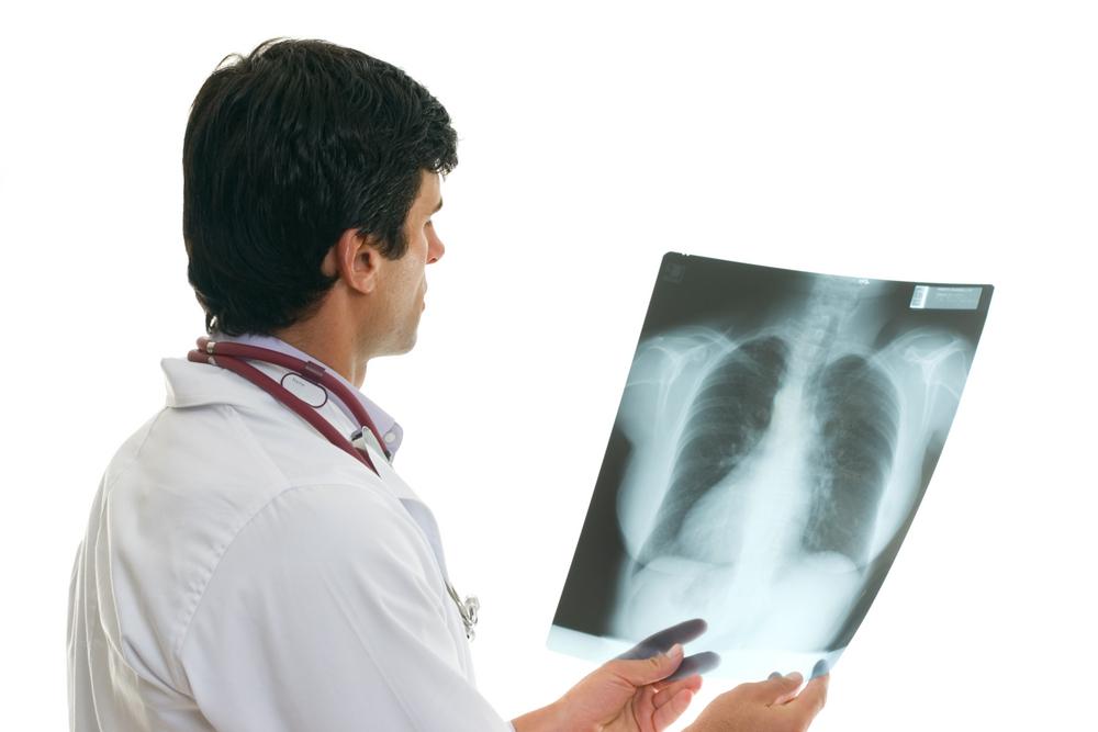 6 Effective Ways of Treating Lung Cancer