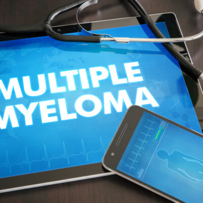 Multiple Myeloma Risk Factors, Complications, and Diagnosis