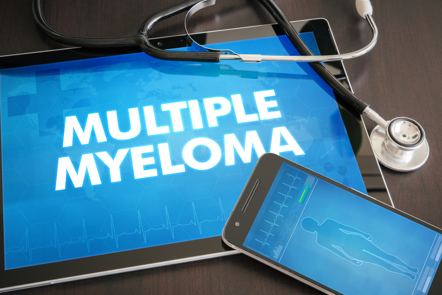 Multiple Myeloma Risk Factors, Complications, and Diagnosis