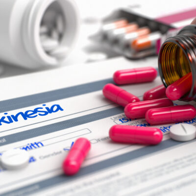 Common Treatments Dyskinesia for in Parkinson’s Patients