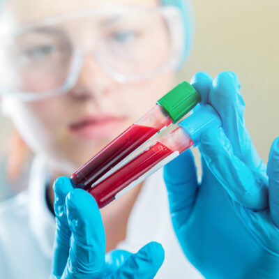 Types of Genetic Testing for Cancer